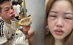 Đã tìm ra "kỳ phùng địch thủ" của giá bể Hải Phòng: Phản ứng dở khóc dở cười của hội thực khách đu trend bánh trứng kiến