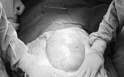 Bé gái 13 tuổi bụng to bất thường, bố mẹ sốc khi phát hiện bí mật "đáng sợ" bên trong