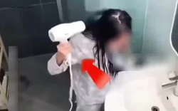 Sấy tóc sau khi gội đầu, cô gái bỏng thâm đen bàn tay: Thói quen ai cũng đã từng mắc phải