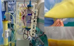 Nam thanh niên 25 tuổi "máu chuyển trắng như sữa" vì thường xuyên ăn món "vạn người mê"