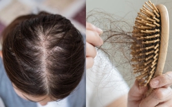Đừng chỉ ăn trứng luộc để ngừa tóc rụng! "Nữ thần không tuổi" Thái Y Lâm luôn làm việc này trước 21h30 cho da đẹp tóc khỏe, bác sĩ cũng phải khen