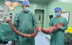 Người đàn ông 4 tháng không đi đại tiện, bụng phình to như "mang thai", bác sĩ lấy ra thứ "đáng sợ"