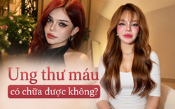 TikToker Đan Thy thông báo mắc ung thư máu ở tuổi 23: Ung thư máu có chữa được không?