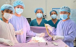 Lươn dài 50cm chọc thủng trực tràng, nằm ngoe nguẩy trong ổ bụng bệnh nhân