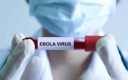 Bệnh Ebola tử vong đến 90%, Bộ Y tế ra chỉ đạo khẩn, yêu cầu cách ly nghiêm ngặt