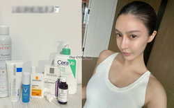 Từ ngày dùng 6 món dược mỹ phẩm bình dân, làn da của cô nàng này ngày một ổn định hơn và ít kích ứng