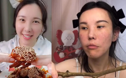 Mặt cô gái trẻ biến dạng sau 2 năm làm mukbang, bác sĩ cảnh báo 4 cái giá phải trả về sức khỏe ít ai biết đến