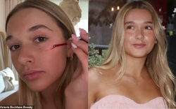 Tiểu thư Harper Beckham dậy thì mặt đầy mụn vì skincare sai cách, làm cả slide thuyết trình xin Victoria... được uốn tóc