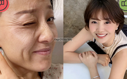 6 thói quen tai hại khiến nếp nhăn vùng mắt ngày càng hằn sâu, đẩy nhanh lão hóa
