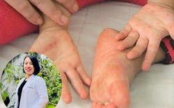 BS khoa Nhi cảnh báo dấu hiệu virus tấn công tế bào thần kinh, cha mẹ không được bỏ qua