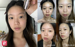 Review 1 tháng dùng serum vitamin C: Làn da có thêm "điểm cộng" nhưng cũng cần lưu ý