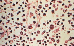 Đài Loan ghi nhận 1 ca tử vong do nhiễm virus Hanta