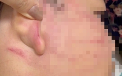 Vụ thầy giáo Ấn Độ tát học sinh lớp 4: Dừng hoạt động lớp dạy thêm