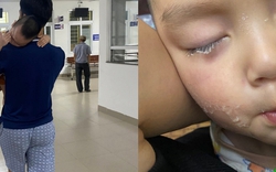 Suýt hối hận cả đời vì vài phút lơ đễnh: Lại thêm 1 em bé bị keo 502 dính vào mắt