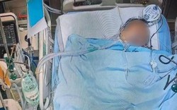 Người đàn ông 57 tuổi tử vong vì thường xuyên ăn 3 món khoái khẩu "vạn người mê"