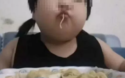 Bé gái 8 tuổi đã nặng 45kg, gan nhiễm mỡ nặng vì mỗi bữa đều ăn quá nhiều 1 món mâm cơm gia đình nào cũng có