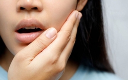 Đi khám răng định kỳ, thiếu nữ 17 tuổi tình cờ phát hiện "vật thể lạ" trong xương hàm và căn bệnh di truyền nguy hiểm suýt bị bỏ quên!