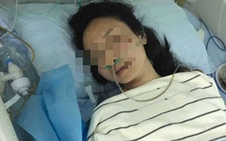 Cả đời né khói thuốc vẫn mắc ung thư phổi, người phụ nữ sốc khi biết "thủ phạm" liên quan đến đam mê nghệ thuật
