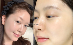 5 lọ serum "retinol kiểu mới" giúp da căng bóng, hỗ trợ tăng sinh collagen mà không lo bong tróc