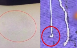 Người phụ nữ đau tay đi khám, bác sĩ kinh ngạc khi thấy thứ bên trong