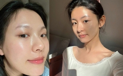 Top 5 retinol chống lão hóa mạnh mẽ: Da căng mịn, tuổi tác như chậm lại