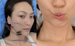 Nữ chính phim trăm tỷ của Trấn Thành: Từng đi bán xôi lề đường, bị biến chứng sau ca mổ tuyến giáp