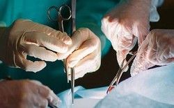 Nhập viện vì đau bụng, người đàn ông 67 tuổi sốc nặng khi bác sĩ gắp ra thứ "đáng sợ" đen sì