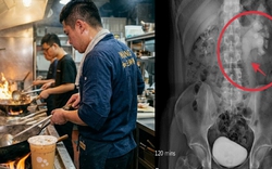 Nam đầu bếp 32 tuổi phù thận cấp tính vì 1 thói quen uống nước không ít người vẫn làm mỗi ngày