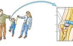 Bác sĩ cảnh báo: Kéo tay con kiểu này, chỉ cần 1 cái cũng có thể khiến trẻ bị trật khớp khuỷu tay