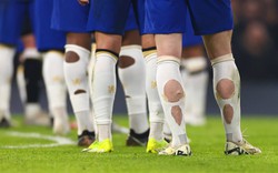 Phát hiện nhiều cầu thủ World Cup đi tất rách ra sân