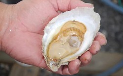 Người đàn ông 50 tuổi bị suy thận cấp sau khi ăn hàu sống