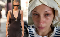 Bella Hadid đau đớn, tàn tạ không nhận ra khi bệnh nặng tái phát