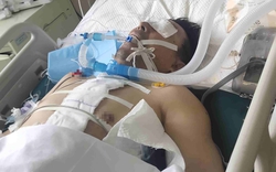 Người đàn ông nguy kịch vì trắng xóa cả 2 bên phổi: Bác sĩ cảnh báo 1 kiểu dùng điều hòa ngang "tự sát"