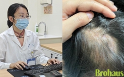 Một cái ôm với thú cưng, một mảng tóc không bao giờ mọc lại: Điều mọi ông bố có con nhỏ cần biết!