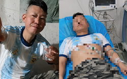 Tiktoker được mệnh danh "thần rượu" tử vong vì suy đa tạng, bác sĩ thở dài: Kết cục khó tránh!