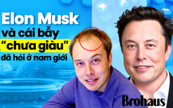 Chưa kịp giàu đã hói: Nghi vấn từ mái tóc hồi sinh của Elon Musk và cái bẫy "cày cuốc" bóp nghẹt phong độ đàn ông