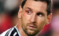 Vì sao Messi "tơi tả", rách cả mí mắt?