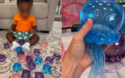 Cảnh báo về món đồ chơi hot Tiktok hàng triệu người đang mua: Con chỉ làm theo một video trên mạng, hậu quả là bỏng mặt và cánh tay