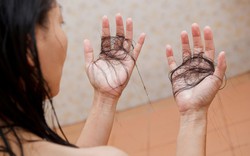 Lời khuyên cho những người hay bị rụng tóc