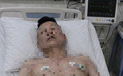 Người đàn ông 46 tuổi tử vong trên giường, bác sĩ cảnh báo loại đồ uống quen thuộc "vạn người mê"