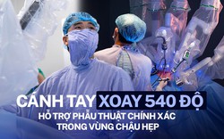 Tận mắt chứng kiến bác sĩ ở Hà Nội điều khiển robot cách bệnh nhân hơn 1 mét để cắt khối u ung thư trực tràng