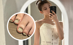 Rợn tóc gáy vì lướt trúng bộ móng chân rong rêu của mỹ nhân top 3 thế giới