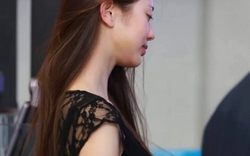 Jang Wonyoung lộ mặt bị thâm tím