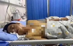 Ung thư gan cướp đi sinh mạng hơn 700.000 người mỗi năm, bác sĩ cảnh báo: Chờ đau thì đã muộn!