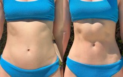Nữ y tá 25 tuổi tiết lộ cách giảm gần 3kg chỉ trong 5 phút không cần bất cứ dụng cụ gì, vợ Justin Bieber cũng rất "chuộng"