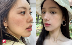 5 sai lầm tưởng nhỏ nhưng lại khiến da dễ bị nám: Nhiều chị em vẫn mắc phải mỗi ngày