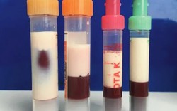 Bé trai 5 tuổi máu "trắng đục như sữa" vì thường xuyên ăn món canh quen thuộc