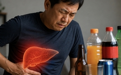 Không chỉ rượu bia: 3 LOẠI đồ uống âm thầm "bào mòn" lá gan, nhiều người uống mỗi ngày