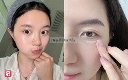 Bác sĩ da liễu chọn ra 6 tuýp kem mắt bình dân giúp cải thiện quầng thâm, nếp nhăn
