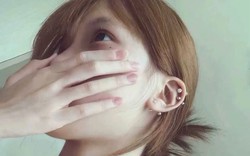 4 bất thường ở vùng đầu cảnh báo tế bào ung thư đang "gặm nhấm" lá phổi